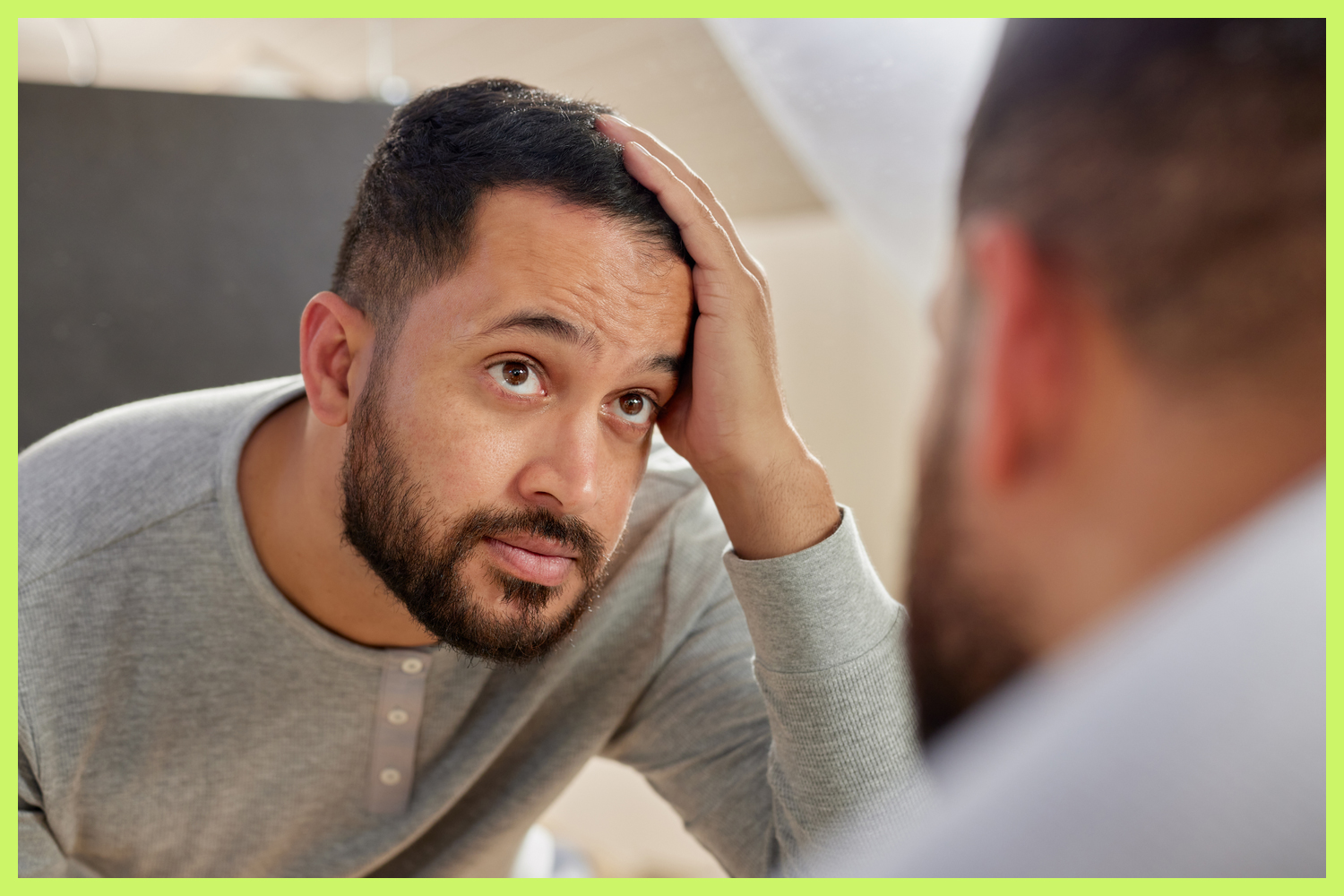 Hormone Replacement Therapy for Men's Hair Loss